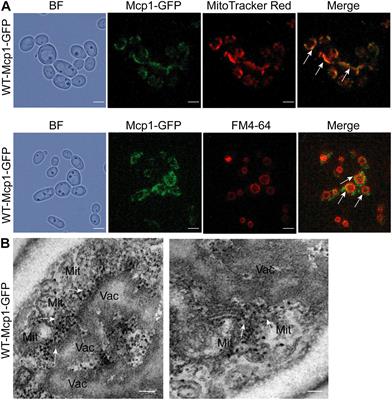 The Vacuole and Mitochondria Patch (vCLAMP) Protein Mcp1 Is Involved in Maintenance of Mitochondrial Function and Mitophagy in Candida albicans